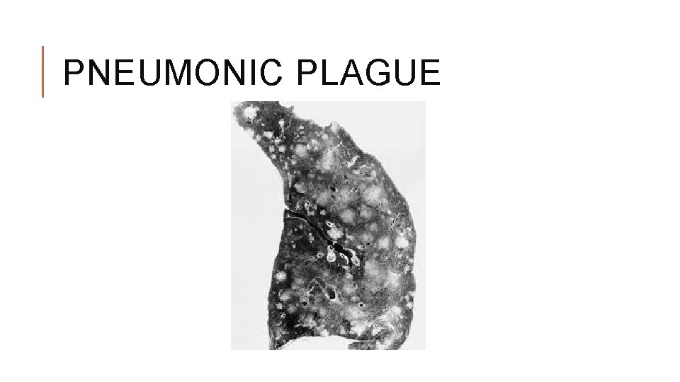 PNEUMONIC PLAGUE 