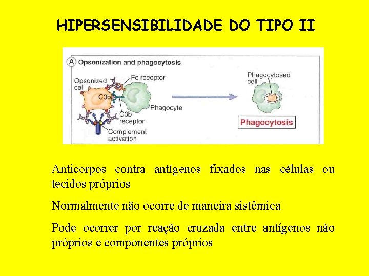 HIPERSENSIBILIDADE DO TIPO II Anticorpos contra antígenos fixados nas células ou tecidos próprios Normalmente