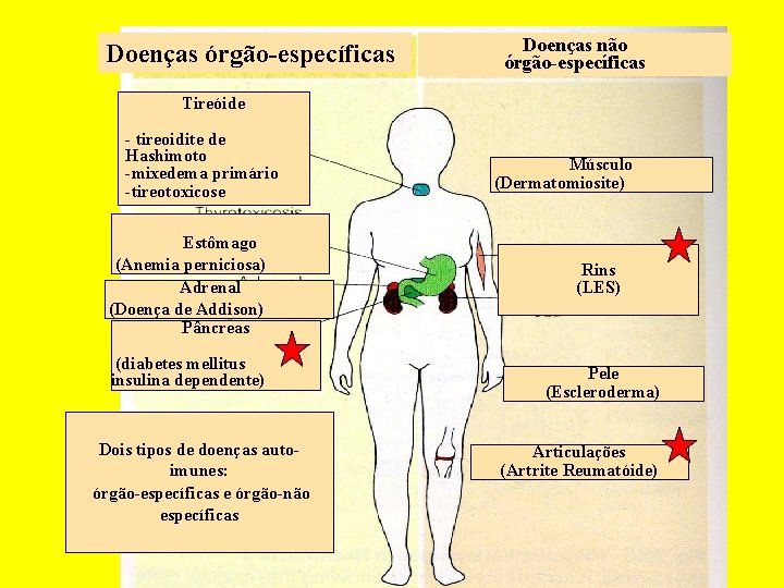 Doenças órgão-específicas Doenças não órgão-específicas Tireóide - tireoidite de Hashimoto -mixedema primário -tireotoxicose Estômago