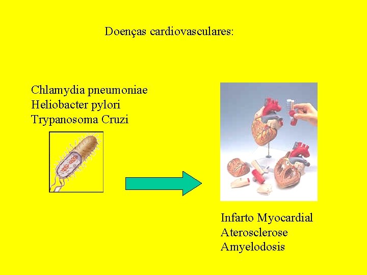 Doenças cardiovasculares: Chlamydia pneumoniae Heliobacter pylori Trypanosoma Cruzi Infarto Myocardial Aterosclerose Amyelodosis 