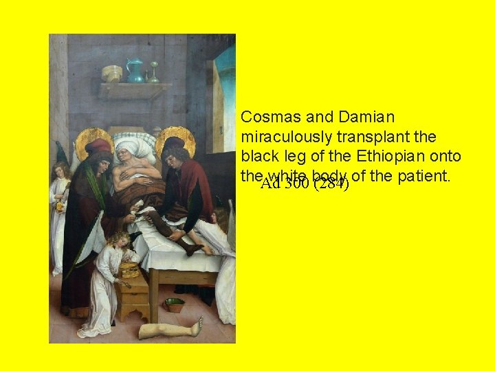 Cosmas and Damian miraculously transplant the black leg of the Ethiopian onto the. Ad