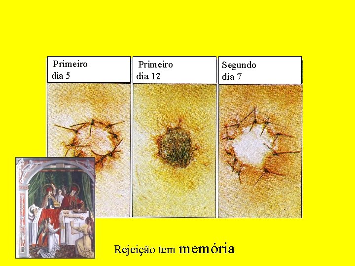 Primeiro dia 5 Primeiro dia 12 Segundo dia 7 Rejeição tem memória 