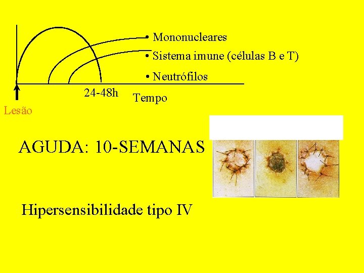  • Mononucleares • Sistema imune (células B e T) • Neutrófilos 24 -48