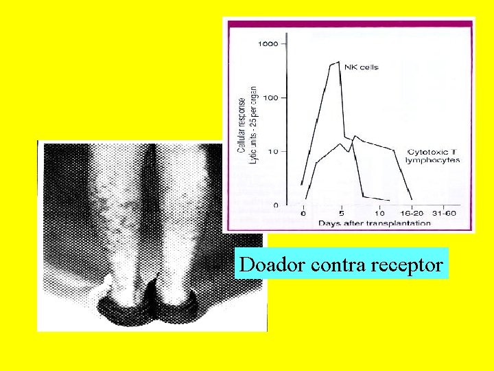 Doador contra receptor 