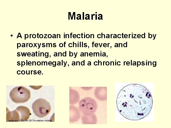 Malaria • A protozoan infection characterized by paroxysms of chills, fever, and sweating, and