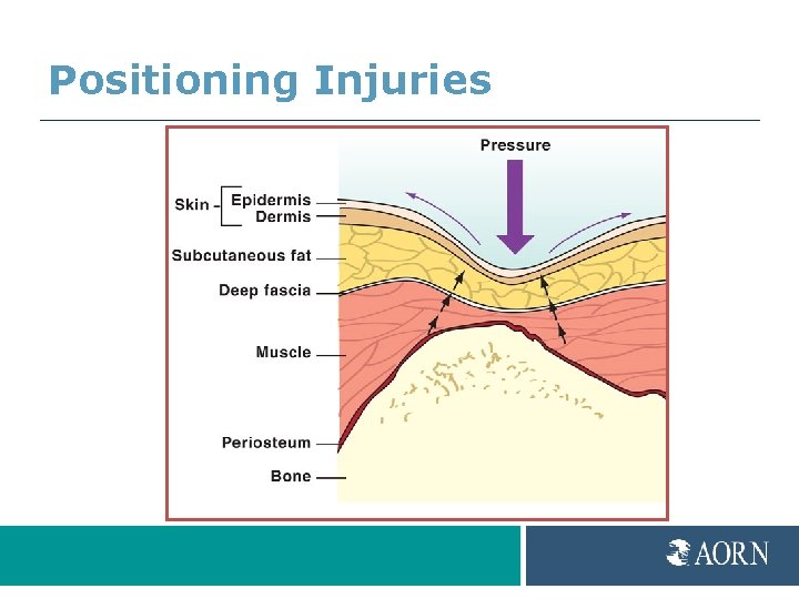 Positioning Injuries 