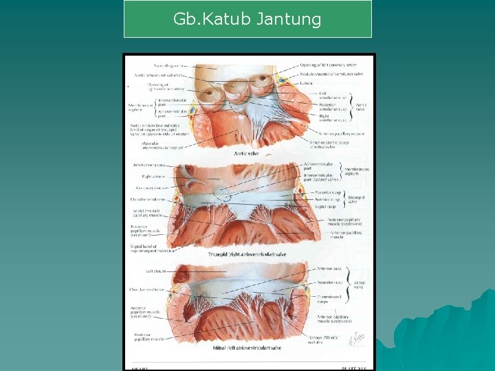 Gb. Katub Jantung 