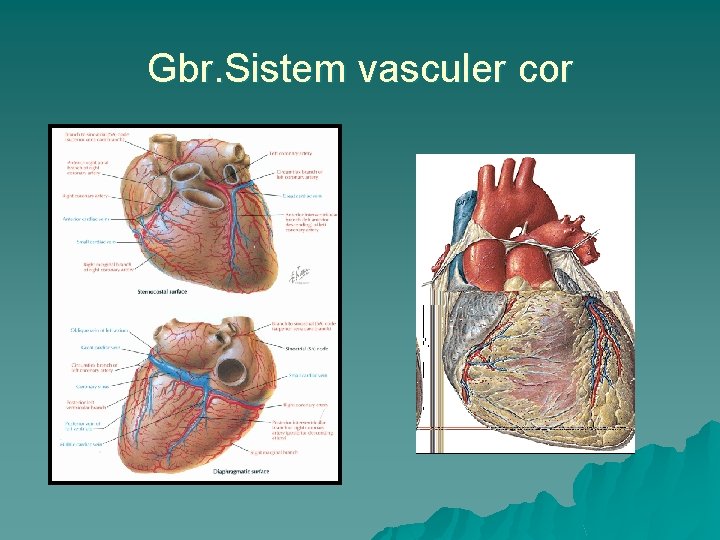 Gbr. Sistem vasculer cor 