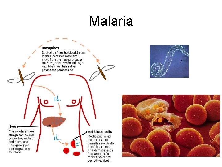 Malaria 