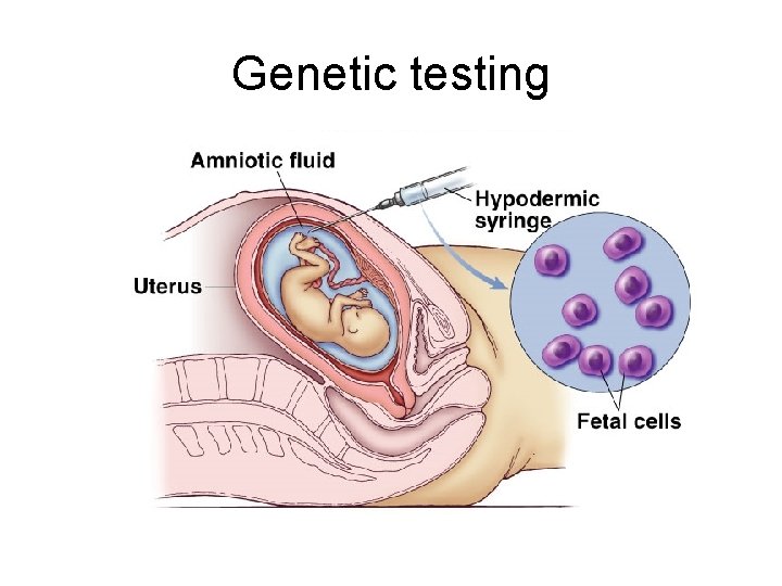 Genetic testing 