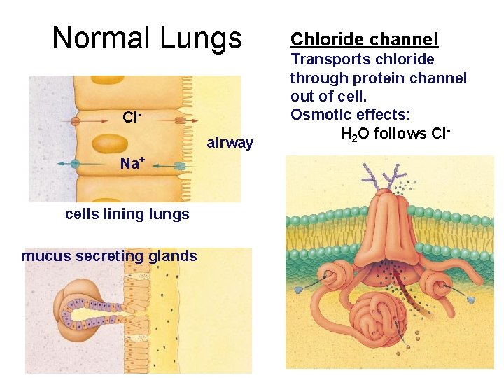 Normal Lungs Clairway Na+ cells lining lungs mucus secreting glands Chloride channel Transports chloride