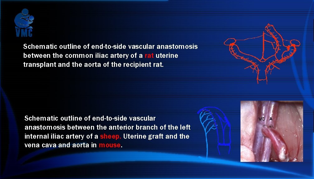 Schematic outline of end-to-side vascular anastomosis between the common iliac artery of a rat