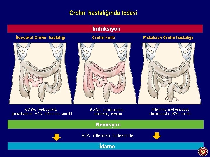 Crohn hastalığında tedavi İndüksiyon İleoçekal Crohn hastalığı 5 -ASA, budesonide, prednisolone, AZA, infliximab, cerrahi