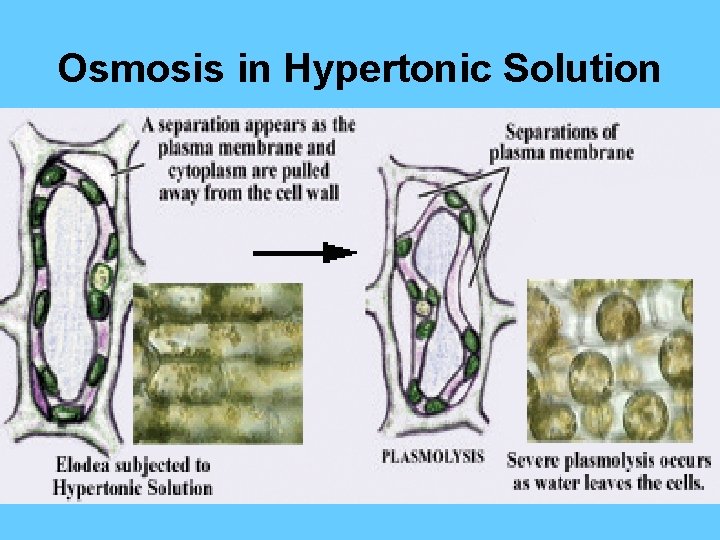 Osmosis in Hypertonic Solution 