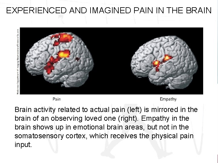 EXPERIENCED AND IMAGINED PAIN IN THE BRAIN Brain activity related to actual pain (left)