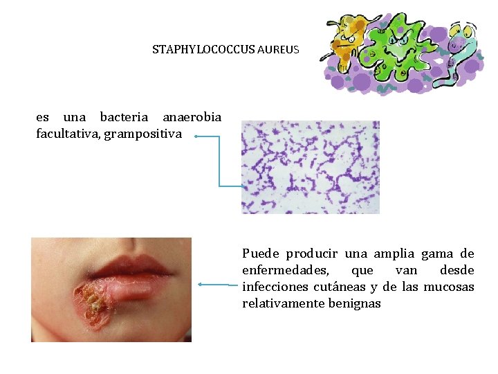 STAPHYLOCOCCUS AUREUS es una bacteria anaerobia facultativa, grampositiva Puede producir una amplia gama de