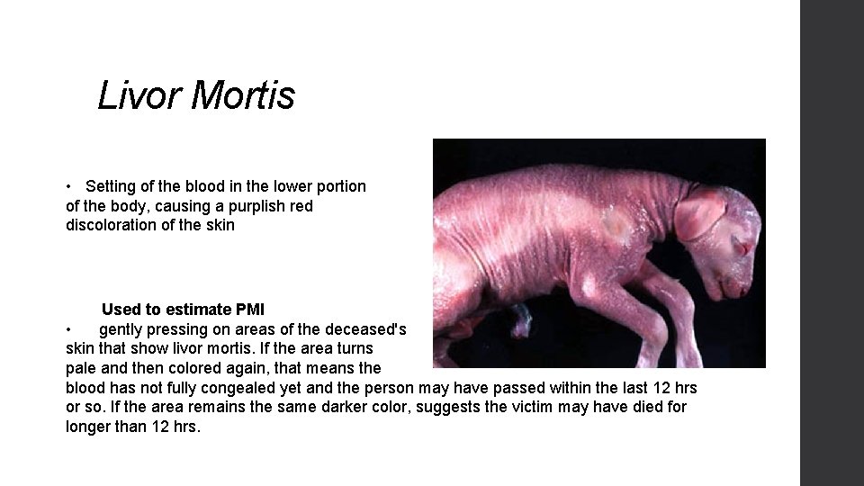 Livor Mortis • Setting of the blood in the lower portion of the body,