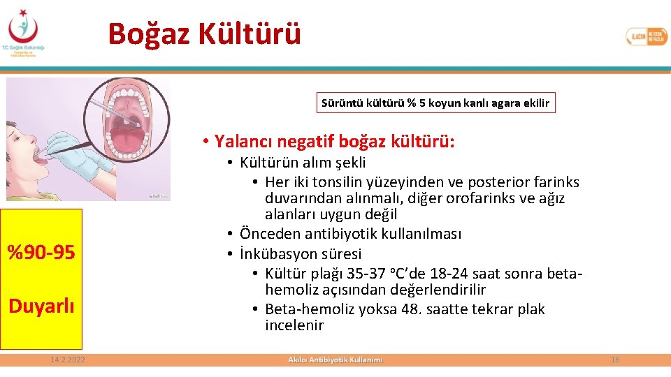 Boğaz Kültürü Sürüntü kültürü % 5 koyun kanlı agara ekilir • Yalancı negatif boğaz