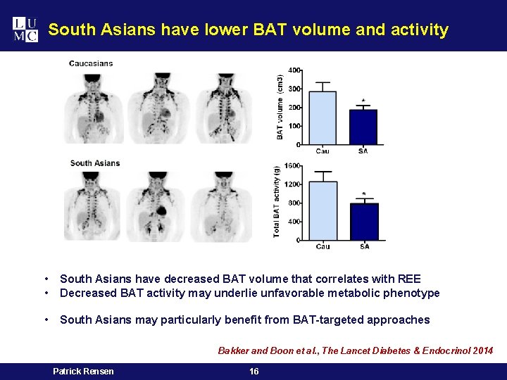 South Asians have lower BAT volume and activity • • South Asians have decreased