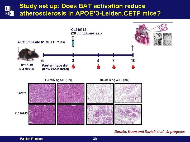 Study set up: Does BAT activation reduce atherosclerosis in APOE*3 -Leiden. CETP mice? CL