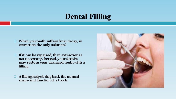 Dental Filling � When you tooth suffers from decay, is extraction the only solution?