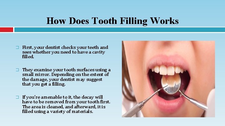 How Does Tooth Filling Works � First, your dentist checks your teeth and sees
