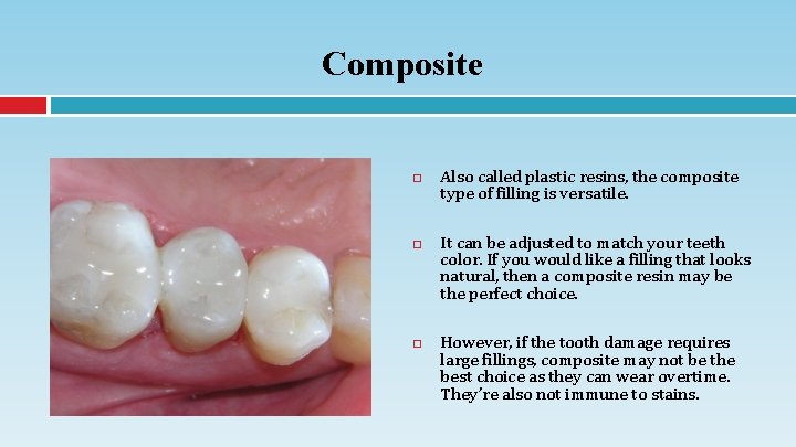 Composite Also called plastic resins, the composite type of filling is versatile. It can