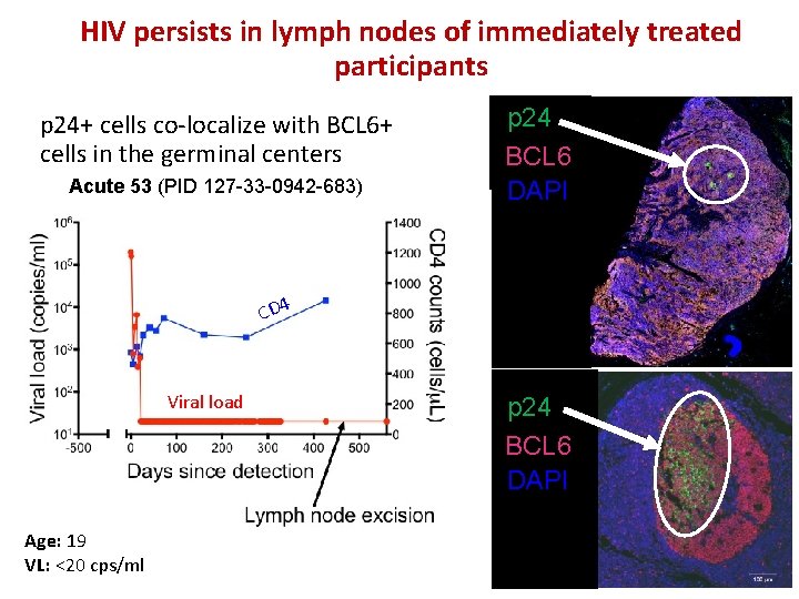 HIV persists in lymph nodes of immediately treated participants p 24+ cells co-localize with