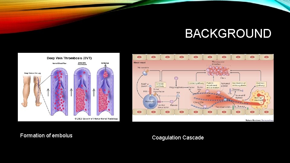 BACKGROUND Formation of embolus Coagulation Cascade 