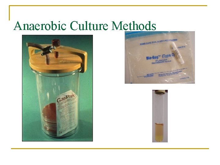 Anaerobic Culture Methods 