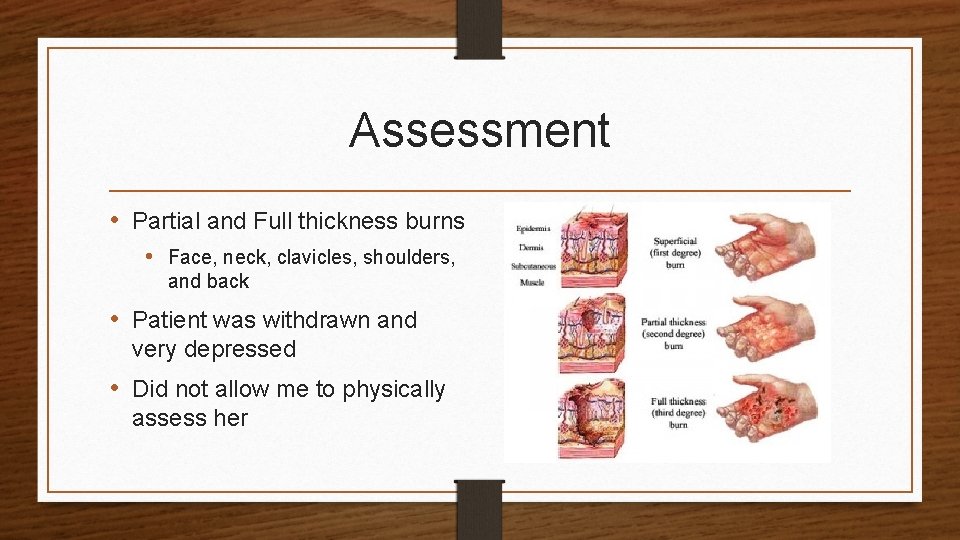 Assessment • Partial and Full thickness burns • Face, neck, clavicles, shoulders, and back