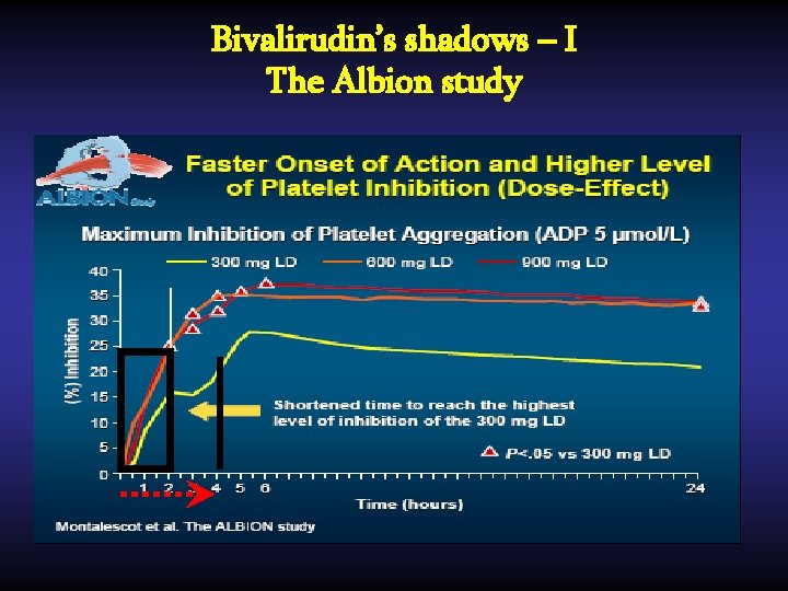 Bivalirudin’s shadows – I The Albion study 