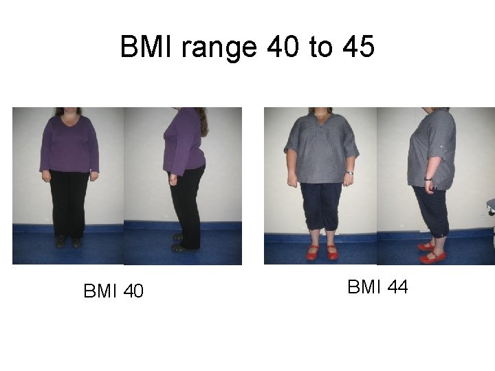 BMI range 40 to 45 BMI 40 BMI 44 