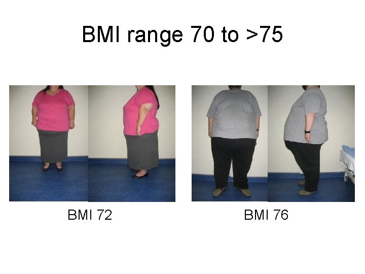 BMI range 70 to >75 BMI 72 BMI 76 