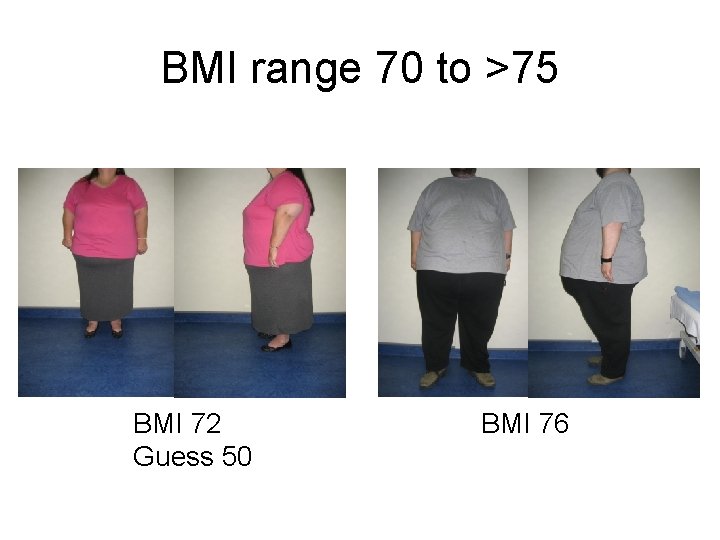 BMI range 70 to >75 BMI 72 Guess 50 BMI 76 
