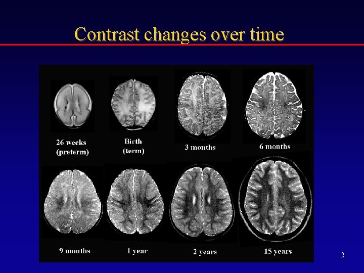 Contrast changes over time 2 