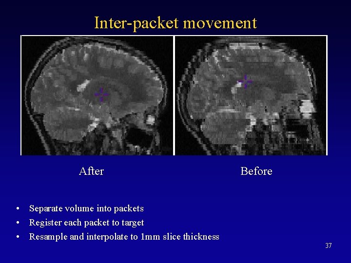 Inter-packet movement After Before • Separate volume into packets • Register each packet to