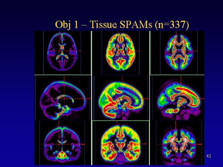 Obj 1 – Tissue SPAMs (n=337) 42 