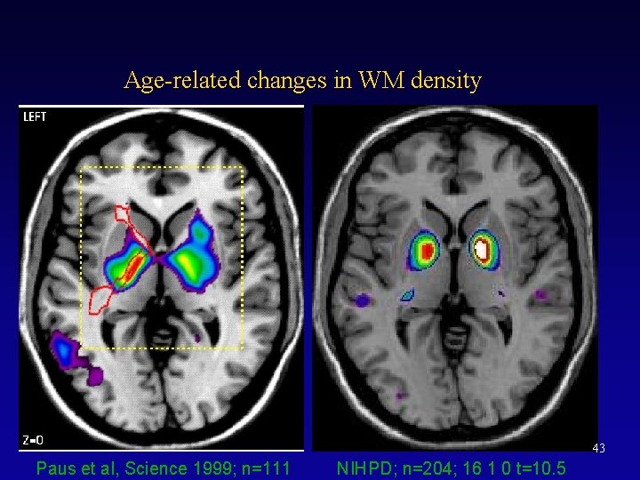 Age-related changes in WM density 43 Paus et al, Science 1999; n=111 NIHPD; n=204;