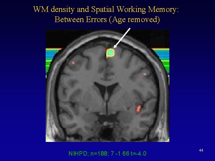 WM density and Spatial Working Memory: Between Errors (Age removed) NIHPD; n=188; 7 -1