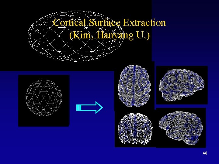 Cortical Surface Extraction (Kim, Hanyang U. ) 46 