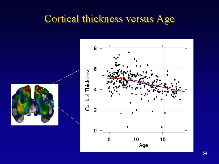 Cortical thickness versus Age 54 