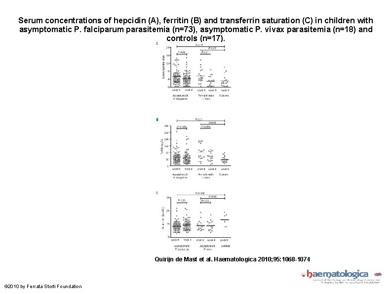 Serum concentrations of hepcidin (A), ferritin (B) and transferrin saturation (C) in children with