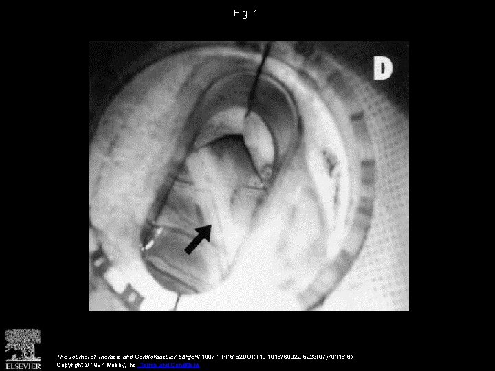 Fig. 1 The Journal of Thoracic and Cardiovascular Surgery 1997 11446 -52 DOI: (10.