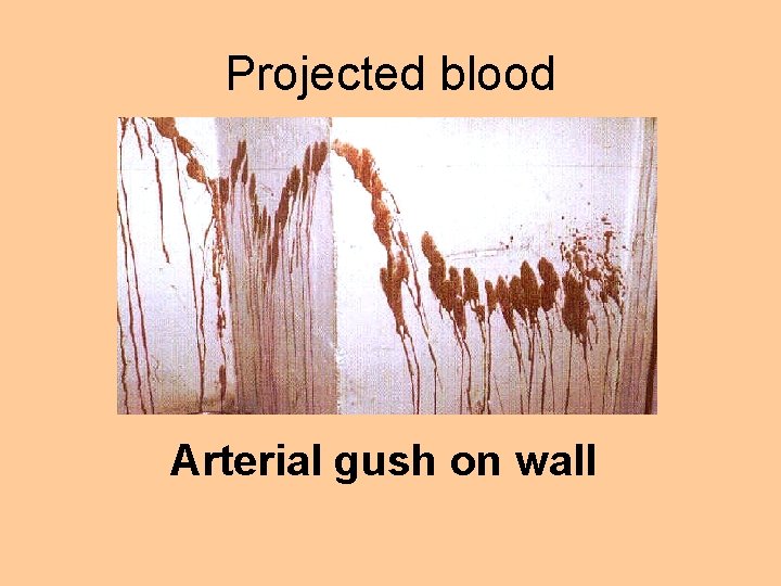 Projected blood Arterial gush on wall 