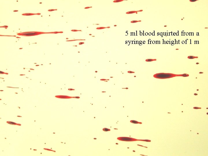5 ml blood squirted from a syringe from height of 1 m Point of