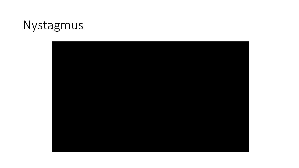 Nystagmus 