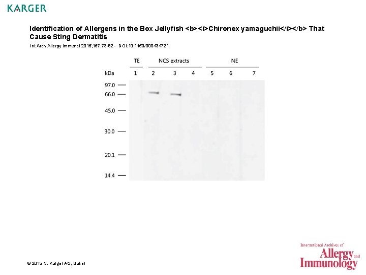 Identification of Allergens in the Box Jellyfish <b><i>Chironex yamaguchii</i></b> That Cause Sting Dermatitis Int