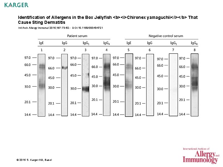 Identification of Allergens in the Box Jellyfish <b><i>Chironex yamaguchii</i></b> That Cause Sting Dermatitis Int