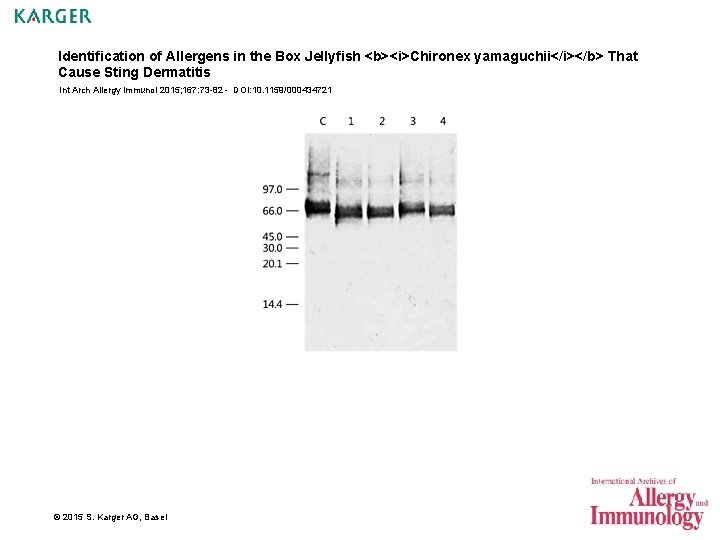 Identification of Allergens in the Box Jellyfish <b><i>Chironex yamaguchii</i></b> That Cause Sting Dermatitis Int